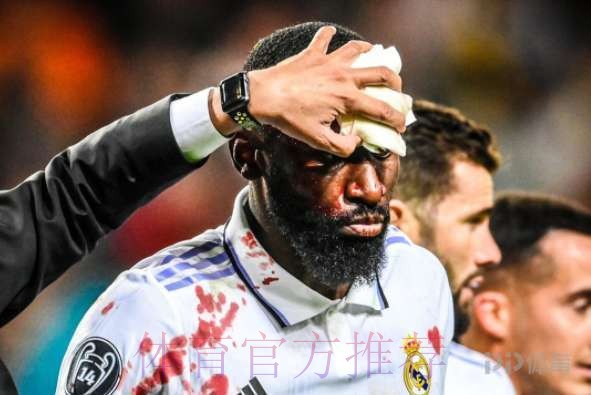 皇马正给吕迪格设计面具 若能睁右眼有望战巴萨